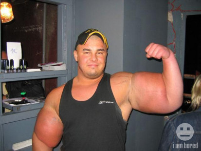 guybigarmssteroids