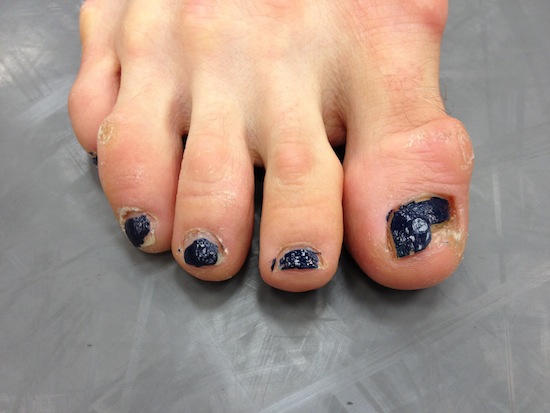 Foot-1