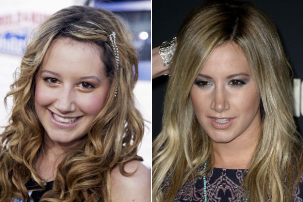 ahsley-tisdale-nose-job-before-after