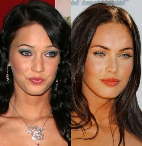 celebrities-plastic-surgery-before-after-01-jpg