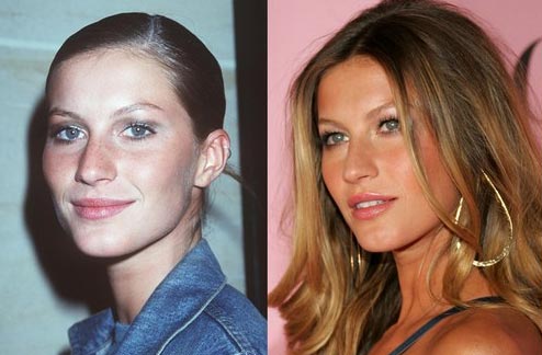 Celebrity-Gisele-Bundchen-Nose-Job