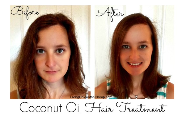 beforeafter