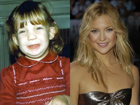 ugly_duckling_celebrities