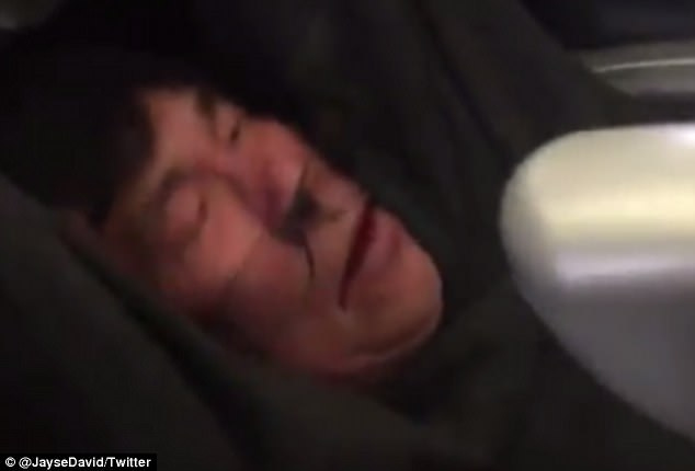 Postarší muž odmítl doplácet na chybu aerolinek. Tak ho personál zmlátil.